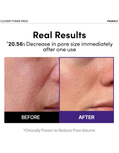 Almohadillas Tonificantes Frankly con Extracto de Arroz 9 Péptidos 2