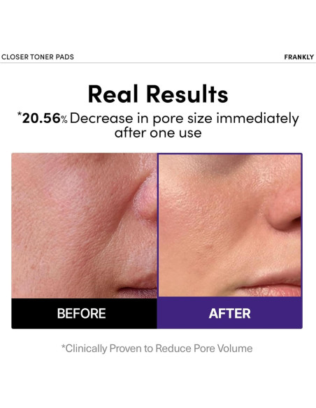 Almohadillas Tonificantes Frankly con Extracto de Arroz 9 Péptidos