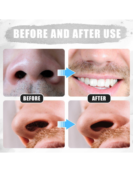 12 Cortadores de Vello Nasal 2 en 1 PEUTIER Negro