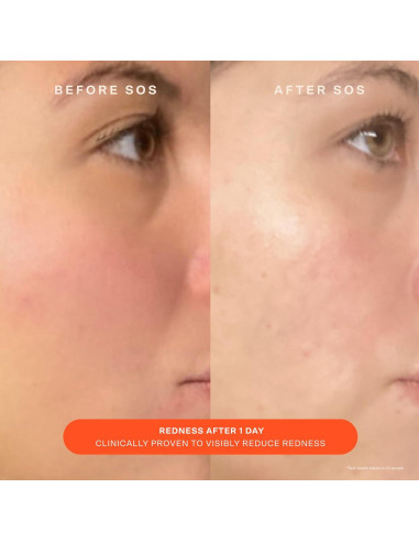Crema y Gel Limpiador SOS Tower 28 para Piel Sensible 150ml
