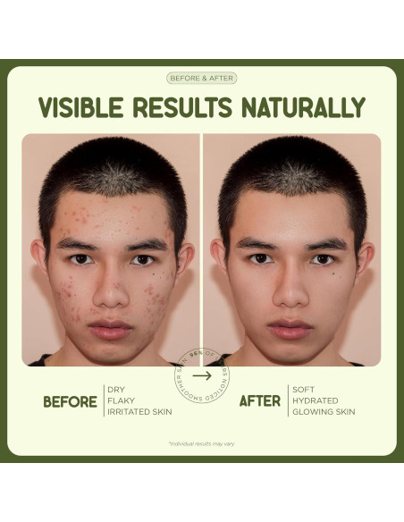 Bálsamo Hidratante Natural Wyld Skincare 113g - Sebo de Res Bálsamo Hidratante Natural Wyld Skincare 113g - Sebo de Res