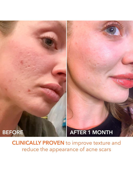 Peeling Diario Dr. Dennis Gross 5 AHA/BHA - 5 Tratamientos Peeling Diario Dr. Dennis Gross 5 AHA/BHA - 5 Tratamientos