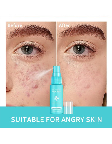 Spray Facial de Rescate Diario Loske 100g - Ácido Hipocloroso