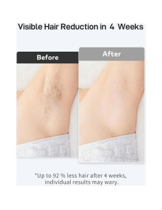 Depiladora láser IPL AMOTAOS PB2 con enfriamiento y rápida 2