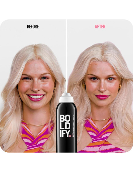 Champú Seco Boldify Revitaliza y Refresca 221g - Volumen y Salud del Cuero Cabelludo Champú Seco Boldify Revitaliza y Refresca 221g - Volumen y Salud del Cuero Cabelludo