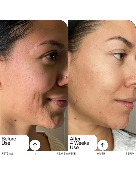 Trío de Sérums Faciales Youth To The People - Retinal, Vitamina C y Cafeína 28.35ml