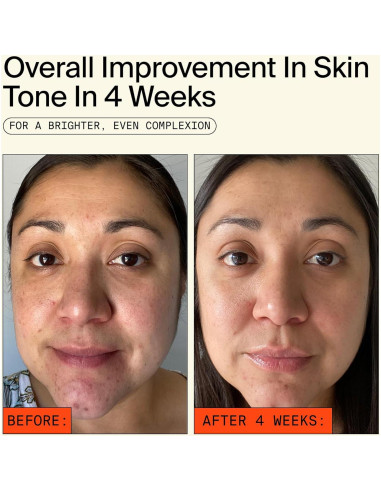 Trío de Sérums Faciales Youth To The People - Retinal, Vitamina C y Cafeína 28.35ml