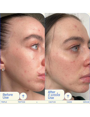 Trío de Sérums Faciales Youth To The People - Retinal, Vitamina C y Cafeína 28.35ml