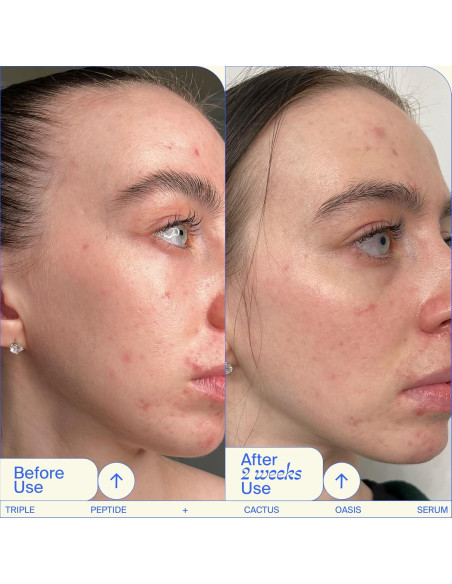 Trío de Sérums Faciales Youth To The People - Retinal, Vitamina C y Cafeína 28.35ml