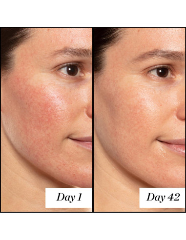 Sérum de Retinol A+ 14.79ml Sunday Riley - Antiarrugas