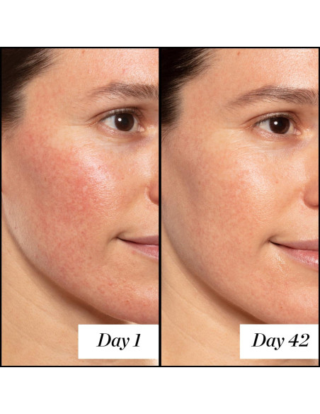 Sérum de Retinol A+ 14.79ml Sunday Riley - Antiarrugas Sérum de Retinol A+ 14.79ml Sunday Riley - Antiarrugas