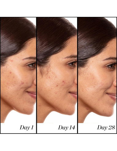 Sérum de Retinol A+ 14.79ml Sunday Riley - Antiarrugas