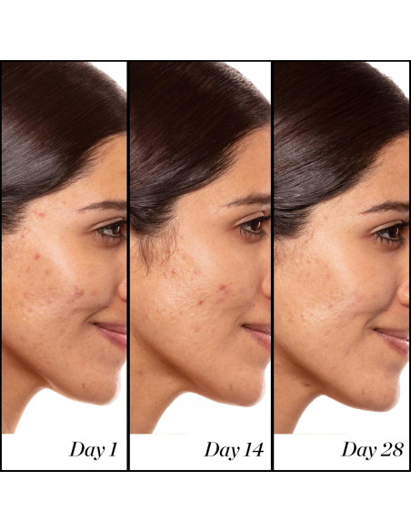 Sérum de Retinol A+ 14.79ml Sunday Riley - Antiarrugas Sérum de Retinol A+ 14.79ml Sunday Riley - Antiarrugas