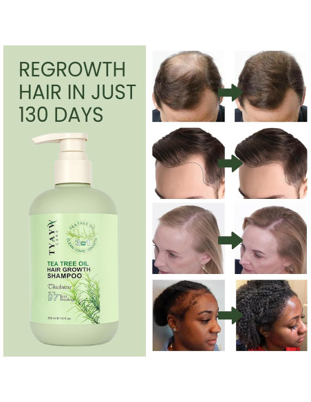 Champú Engrosante Romero y Árbol de Té 300ml JINGDAIBURY