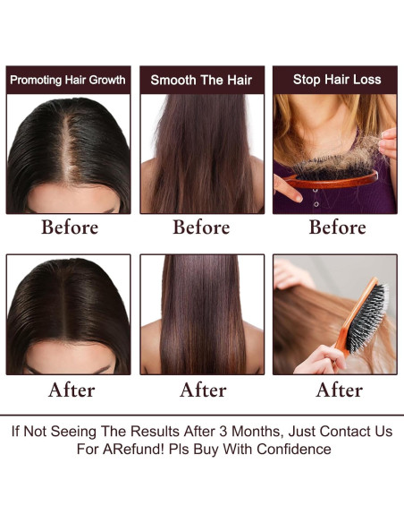 Suero y Champú BEHAPRO para Crecimiento Cabello Fino 340g