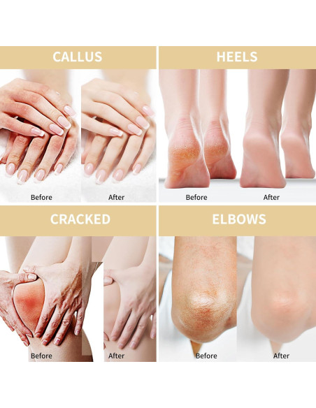 Crema de Urea 50% Grocerism con Avena y Ácido Salicílico 150g Crema de Urea 50% Grocerism con Avena y Ácido Salicílico 150g