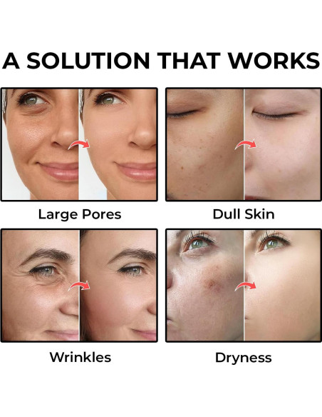 Mascarilla Facial de Colágeno MONIER - Hidratación Profunda 4 Pzas