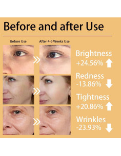 Máscara de Terapia de Luz Roja LED Cloakla W-Fack - 7 Modos 2