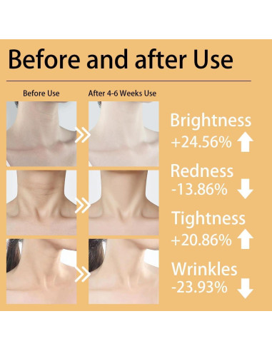 Máscara de Terapia de Luz Roja LED Cloakla W-Fack - 7 Modos