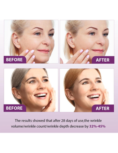 Suero Rejuvenecedor Bakuchiol Retinol Venature 2 Piezas