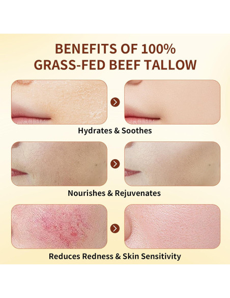 Bálsamo Hidratante Facial ZDQULX con Sebo de Res y Miel 120g