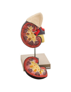 Modelo de Riñón Humano EISCO a Tamaño Real con Glándula Adrenal