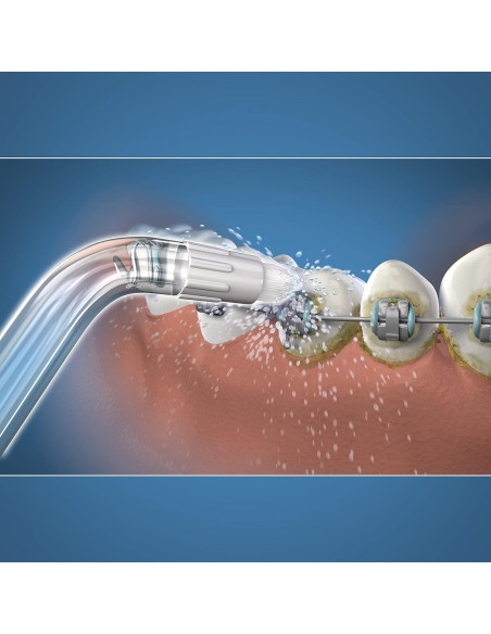 Consejos de Reemplazo Waterpik OD-100E para Brackets Dentales