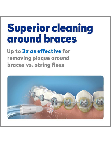 Consejos de Reemplazo Waterpik OD-100E para Brackets Dentales