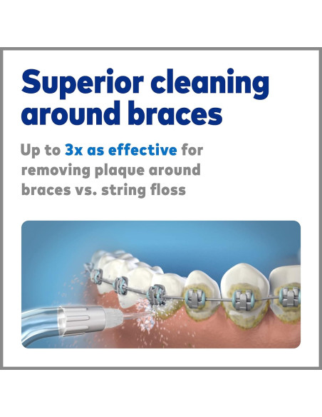 Consejos de Reemplazo Waterpik OD-100E para Brackets Dentales