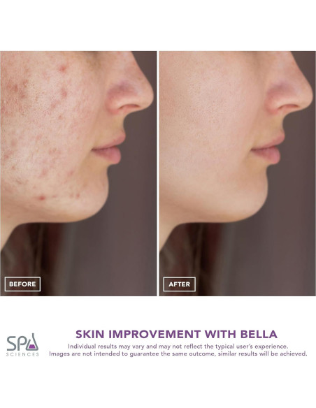 Extractor de Poros Spa Sciences BELLA 3-en-1 Microdermoabrasión