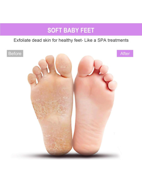 Alfombrilla de Limpieza de Pies BESKAR XL Antideslizante 28x28cm