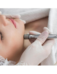 Kit Dermabrasión Diamante Elitzia 3 Varitas 9 Cabezas Aluminio 2