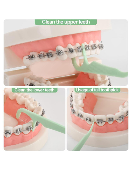 Hilos Dentales Ortodónticos Lakeyface 300 Cuentas para Brackets