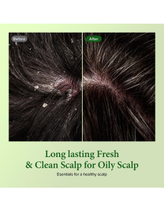 Champú KUNDAL Limpiador Profundo Árbol de Té y Macadamia 300ml - Paquete de 2 2