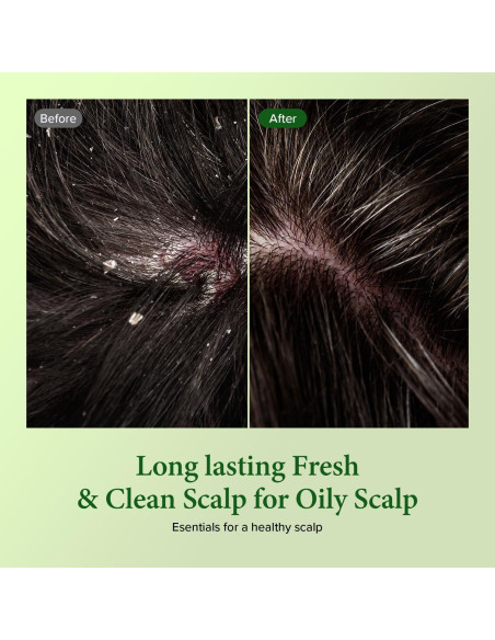 Champú KUNDAL Limpiador Profundo Árbol de Té y Macadamia 300ml - Paquete de 2