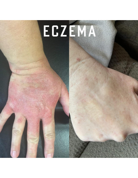 Aceite de Oliva Ozonizado Orgánico Simply O3 59 ml para Piel