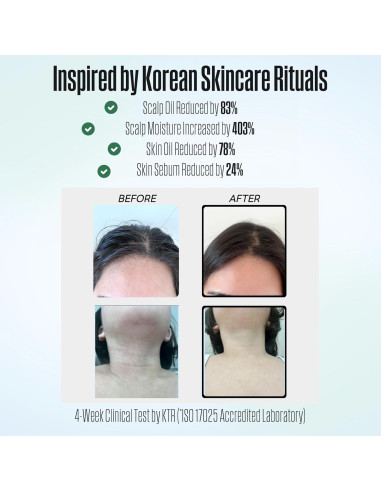 Cabezal de Ducha Filtrado Poseion BT100DG - Alta Presión, Agua Magnetizada