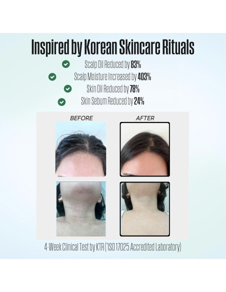 Cabezal de Ducha Filtrado Poseion BT100DG - Alta Presión, Agua Magnetizada