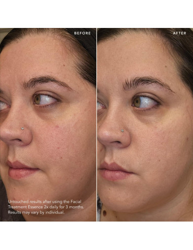 SK-II Esencia Facial Antienvejecimiento 74 ml - Reduce Arrugas