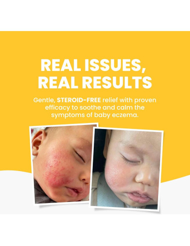 Crema Hidratante para Eccema Bebé Grahams 75g - Natural y Suave