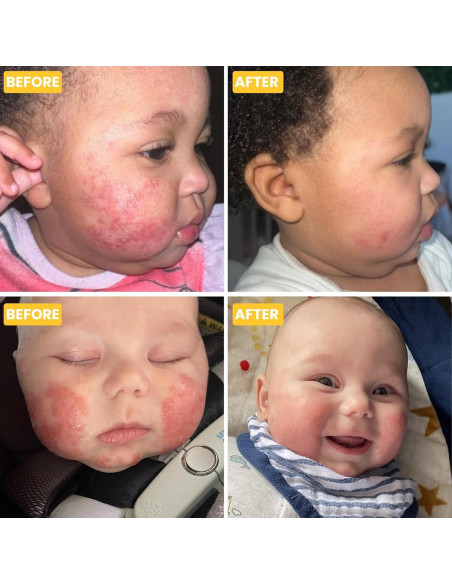 Crema Hidratante para Eccema Bebé Grahams 75g - Natural y Suave