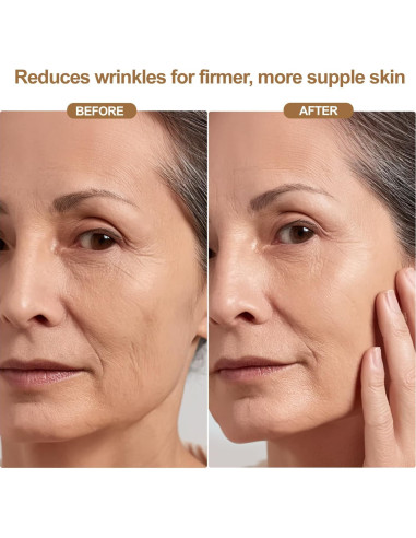 Máscara de Terapia de Luz Roja Inalámbrica LED 850nm - Cuidado Facial