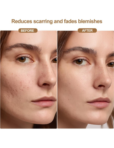 Máscara de Terapia de Luz Roja Inalámbrica LED 850nm - Cuidado Facial