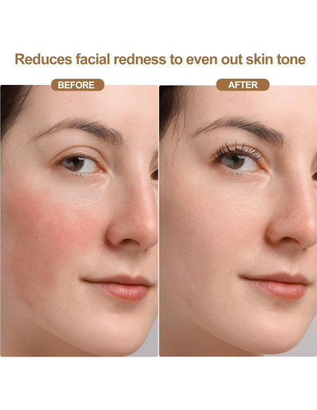 Máscara de Terapia de Luz Roja Inalámbrica LED 850nm - Cuidado Facial