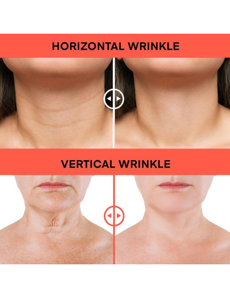 Crema de Retinol Anti-Envejecimiento ZDQULX 100 ml con Colágeno