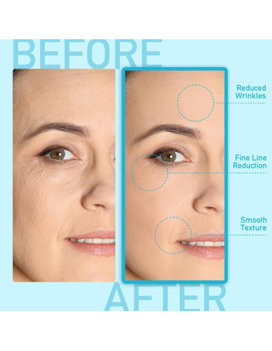 Bálsamo Hidratante Antiarrugas Enaskin Naturals 40g Retinol