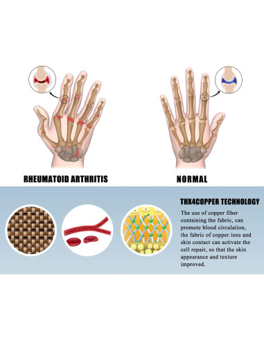 Guantes de Compresión Thx4Copper para Artritis - Talla Pequeña