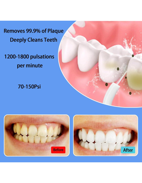 Irrigador Oral Portátil Boicafe Rosa con 3 Modos y 4 Puntas