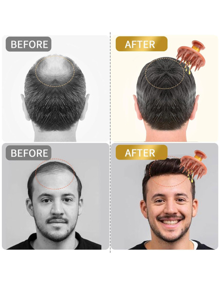 Aplicador de Aceite para Cabello TOCULAB con Masajeador Silicona