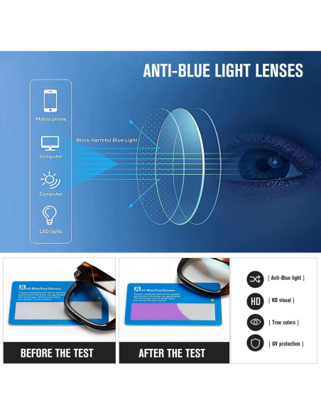 Gafas bloqueadoras de luz azul Kimorn, marco cuadrado, unisex